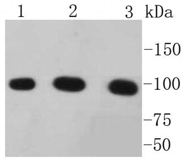 Catenin alpha-1 Antibody in Western Blot (WB)