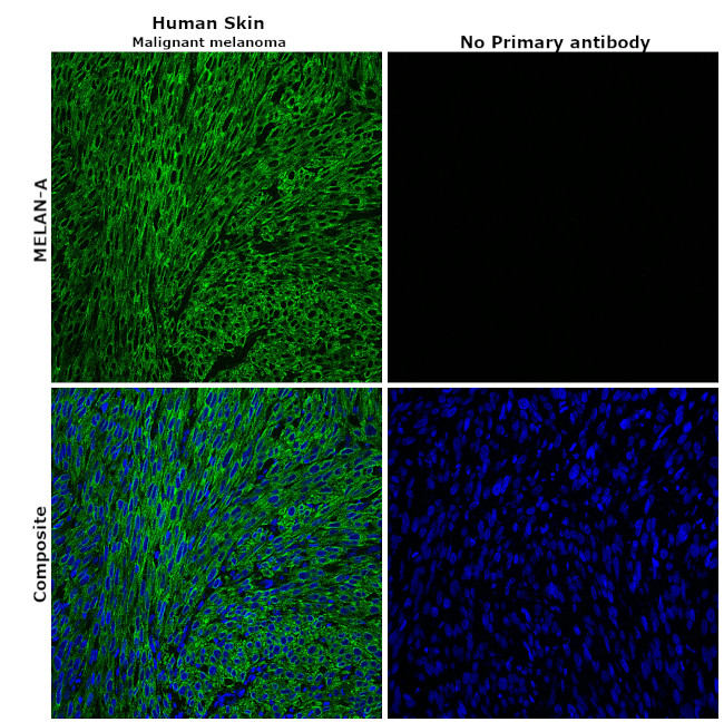 Melan-A Antibody in Immunohistochemistry (Paraffin) (IHC (P))