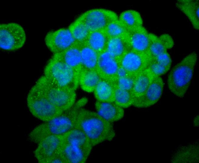 Asparagine Synthetase Antibody in Immunocytochemistry (ICC/IF)