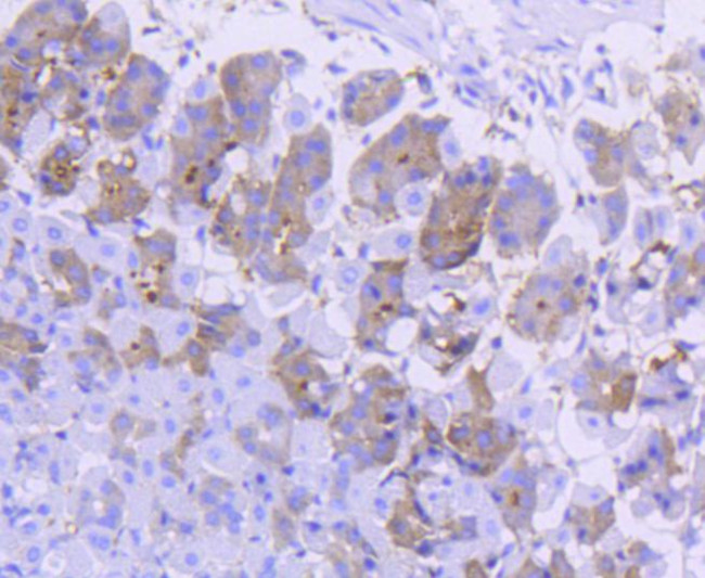 Asparagine Synthetase Antibody in Immunohistochemistry (Paraffin) (IHC (P))