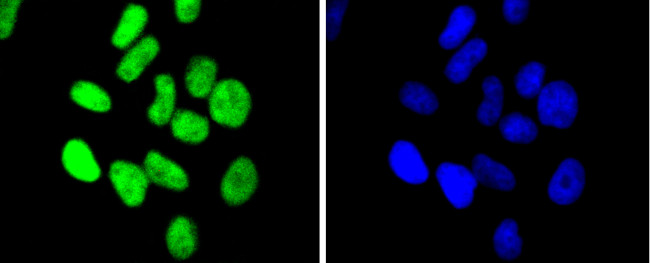 CHK2 Antibody in Immunocytochemistry (ICC/IF)