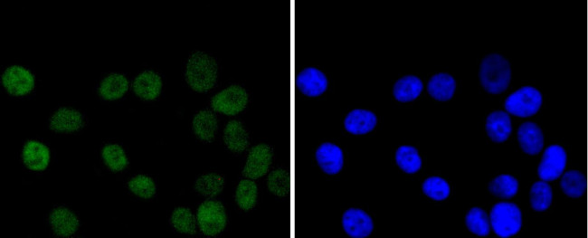 CHK2 Antibody in Immunocytochemistry (ICC/IF)