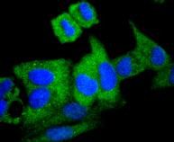 ATG7 Antibody in Immunocytochemistry (ICC/IF)