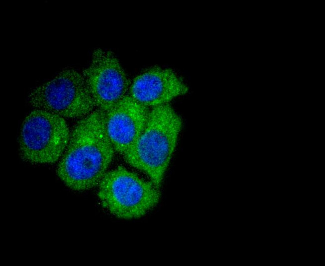 ATG7 Antibody in Immunocytochemistry (ICC/IF)