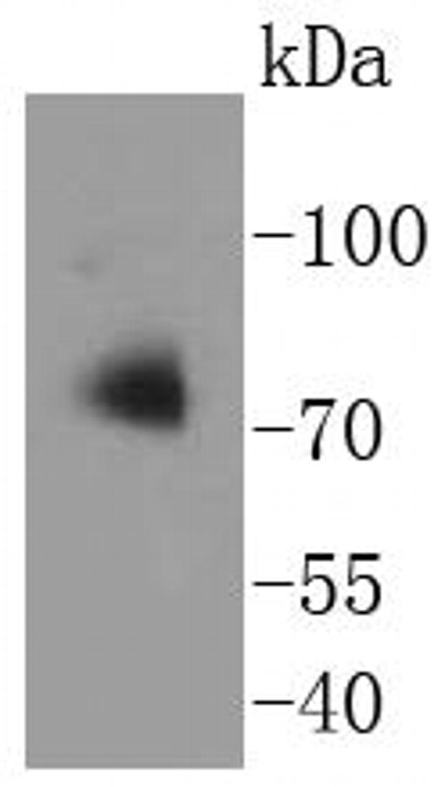 ATG7 Antibody in Western Blot (WB)