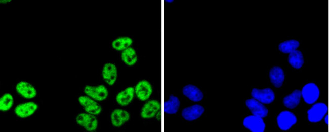 PRP19 Antibody in Immunocytochemistry (ICC/IF)