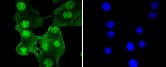 PRP19 Antibody in Immunocytochemistry (ICC/IF)