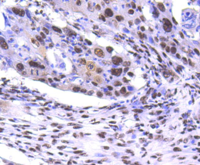 PRP19 Antibody in Immunohistochemistry (Paraffin) (IHC (P))