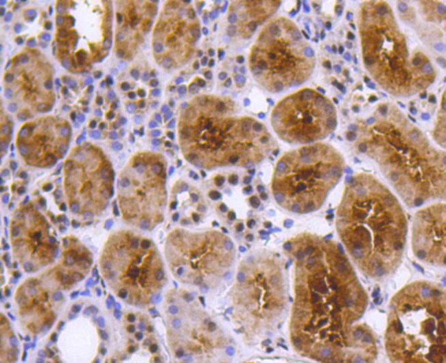 PRP19 Antibody in Immunohistochemistry (Paraffin) (IHC (P))