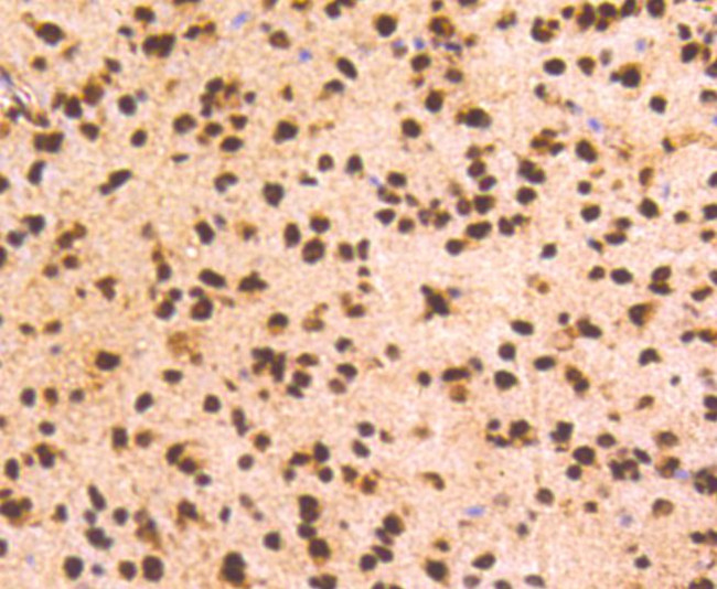 PRP19 Antibody in Immunohistochemistry (Paraffin) (IHC (P))