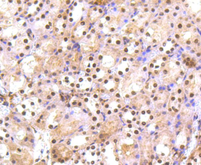 PRP19 Antibody in Immunohistochemistry (Paraffin) (IHC (P))