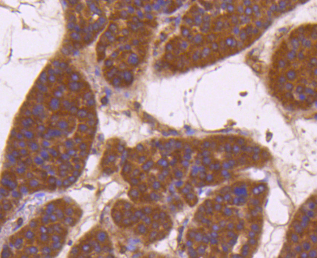 CD13 Antibody in Immunohistochemistry (Paraffin) (IHC (P))