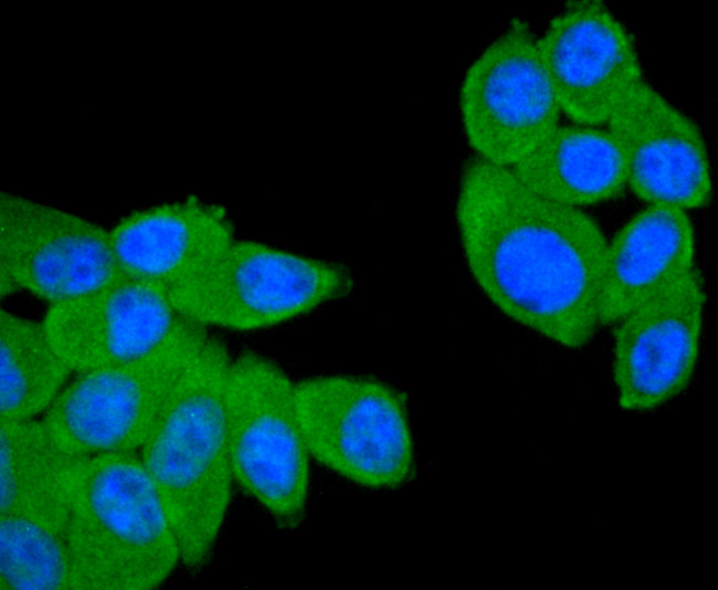 CD21 Antibody in Immunocytochemistry (ICC/IF)