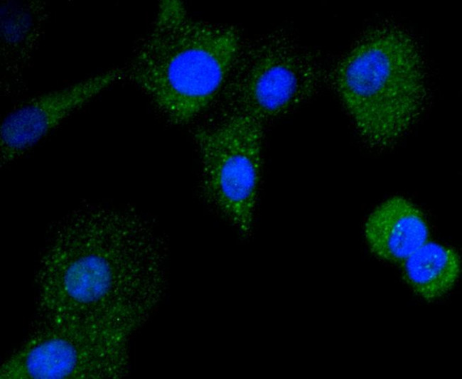 CD21 Antibody in Immunocytochemistry (ICC/IF)