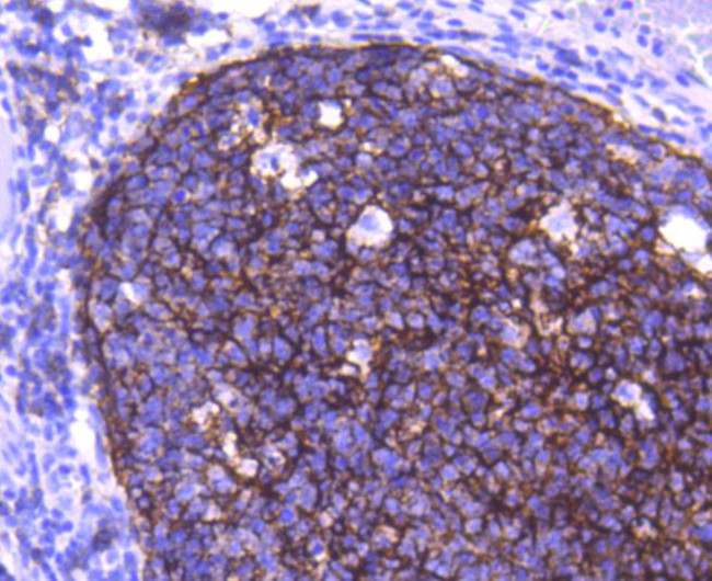 CD21 Antibody in Immunohistochemistry (Paraffin) (IHC (P))