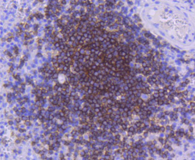 CD21 Antibody in Immunohistochemistry (Paraffin) (IHC (P))