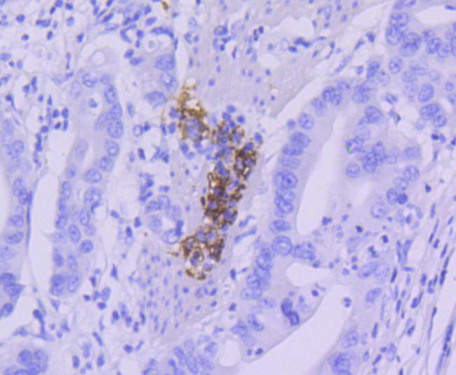 CD21 Antibody in Immunohistochemistry (Paraffin) (IHC (P))