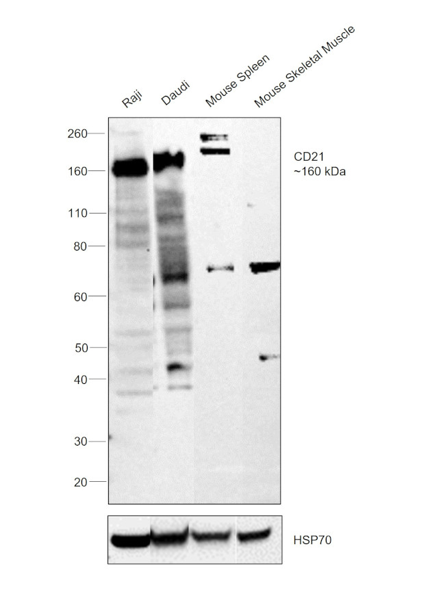 CD21 Antibody in Western Blot (WB)