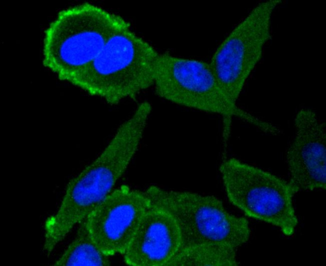 Moesin Antibody in Immunocytochemistry (ICC/IF)