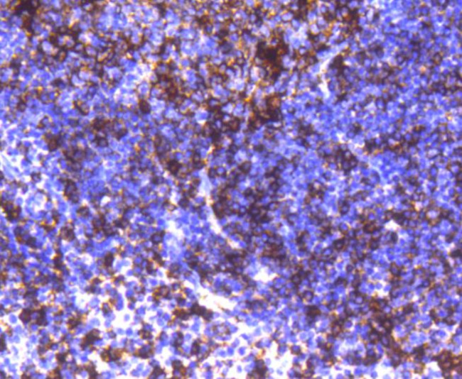 HLA-DR Antibody in Immunohistochemistry (Paraffin) (IHC (P))