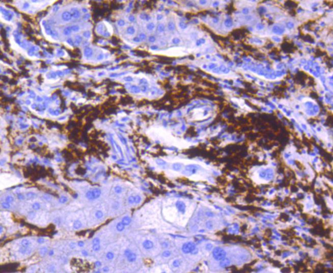 HLA-DR Antibody in Immunohistochemistry (Paraffin) (IHC (P))