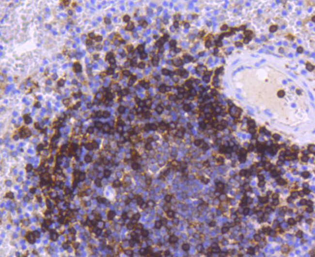 HLA-DR Antibody in Immunohistochemistry (Paraffin) (IHC (P))