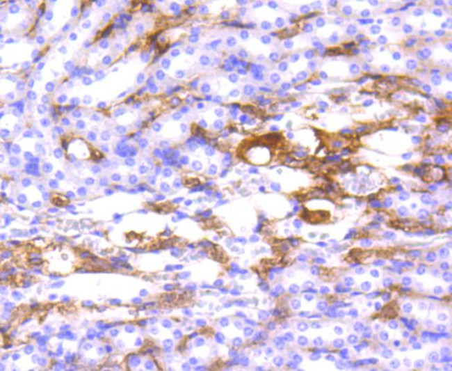 HLA-DR Antibody in Immunohistochemistry (Paraffin) (IHC (P))