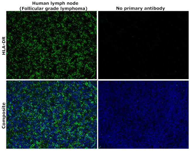 HLA-DR Antibody in Immunohistochemistry (Paraffin) (IHC (P))