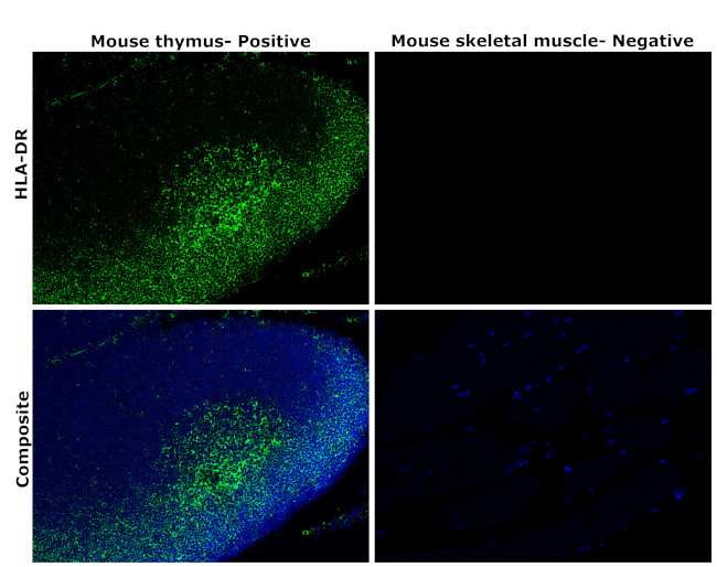 HLA-DR Antibody in Immunohistochemistry (Paraffin) (IHC (P))