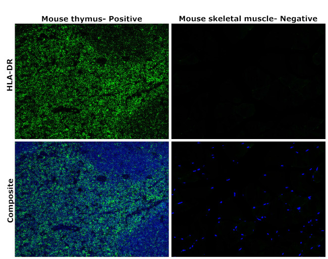 HLA-DR Antibody in Immunohistochemistry (Paraffin) (IHC (P))