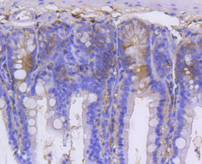 GARS Antibody in Immunohistochemistry (Paraffin) (IHC (P))