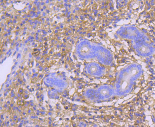 GART Antibody in Immunohistochemistry (Paraffin) (IHC (P))