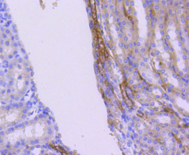 WAVE2 Antibody in Immunohistochemistry (Paraffin) (IHC (P))