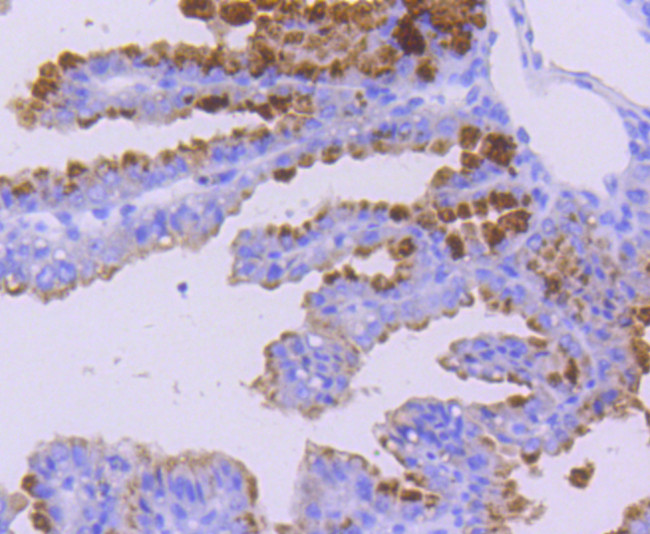 WAVE2 Antibody in Immunohistochemistry (Paraffin) (IHC (P))