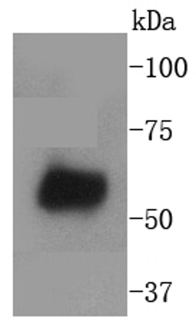 WAVE2 Antibody in Western Blot (WB)