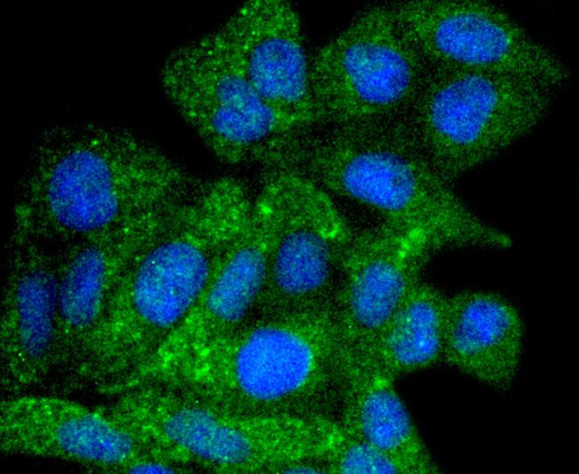 ATG9A Antibody in Immunocytochemistry (ICC/IF)