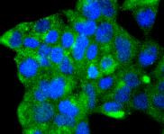 ATG9A Antibody in Immunocytochemistry (ICC/IF)