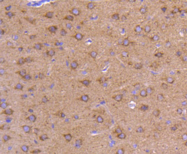 ATG9A Antibody in Immunohistochemistry (Paraffin) (IHC (P))