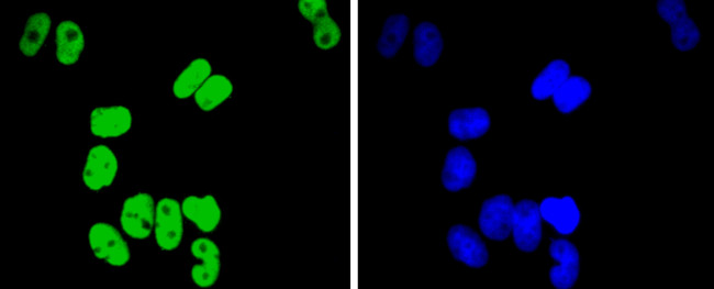 TCF7L2 Antibody in Immunocytochemistry (ICC/IF)