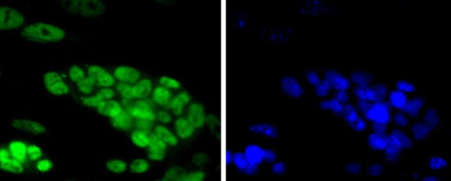 TCF7L2 Antibody in Immunocytochemistry (ICC/IF)