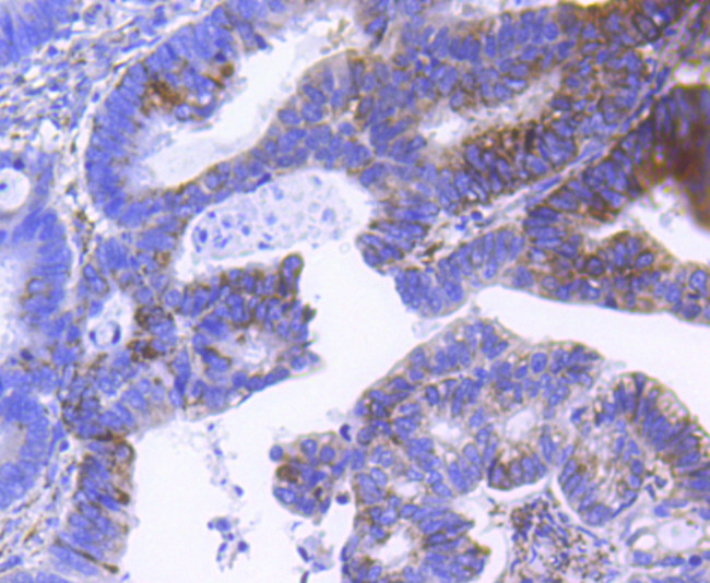 SCF Antibody in Immunohistochemistry (Paraffin) (IHC (P))