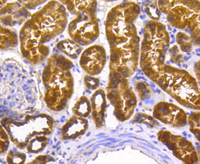 SCF Antibody in Immunohistochemistry (Paraffin) (IHC (P))