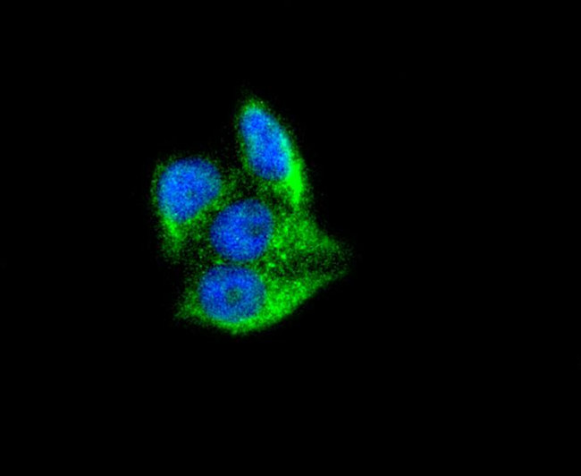 Ferritin Antibody in Immunocytochemistry (ICC/IF)