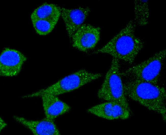 Ferritin Antibody in Immunocytochemistry (ICC/IF)