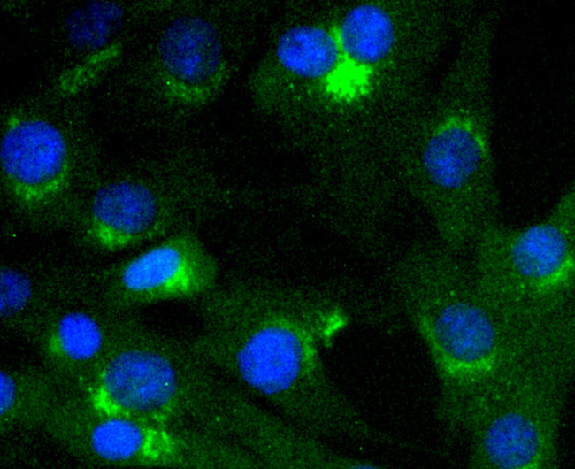 VAV2 Antibody in Immunocytochemistry (ICC/IF)