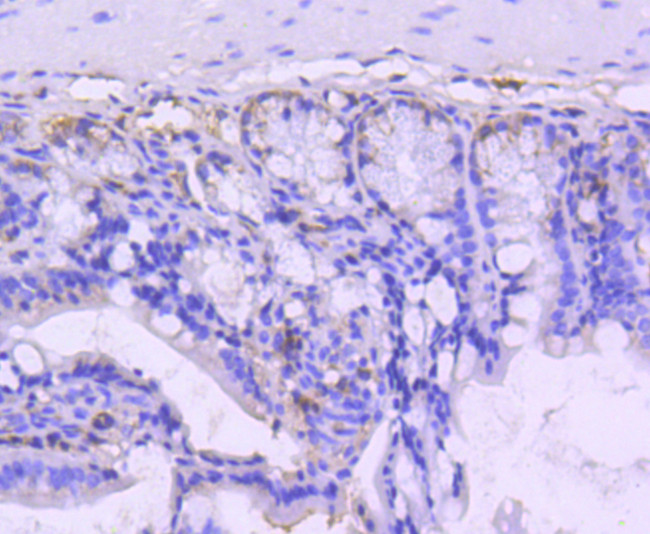 VAV2 Antibody in Immunohistochemistry (Paraffin) (IHC (P))