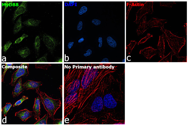 MyD88 Antibody in Immunocytochemistry (ICC/IF)