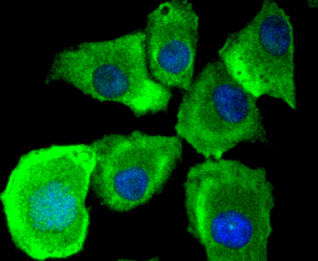 MyD88 Antibody in Immunocytochemistry (ICC/IF)