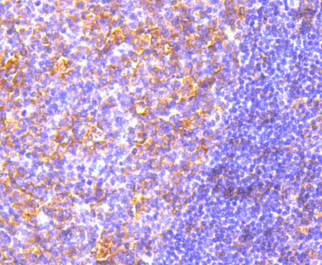 MyD88 Antibody in Immunohistochemistry (Paraffin) (IHC (P))