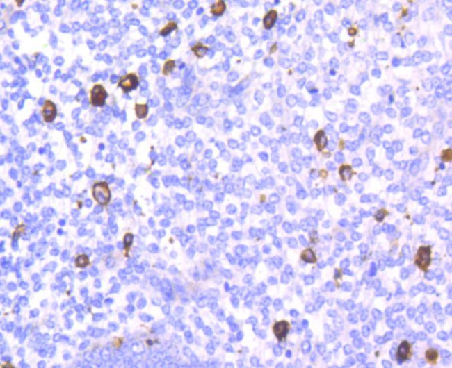 CD14 Antibody in Immunohistochemistry (Paraffin) (IHC (P))